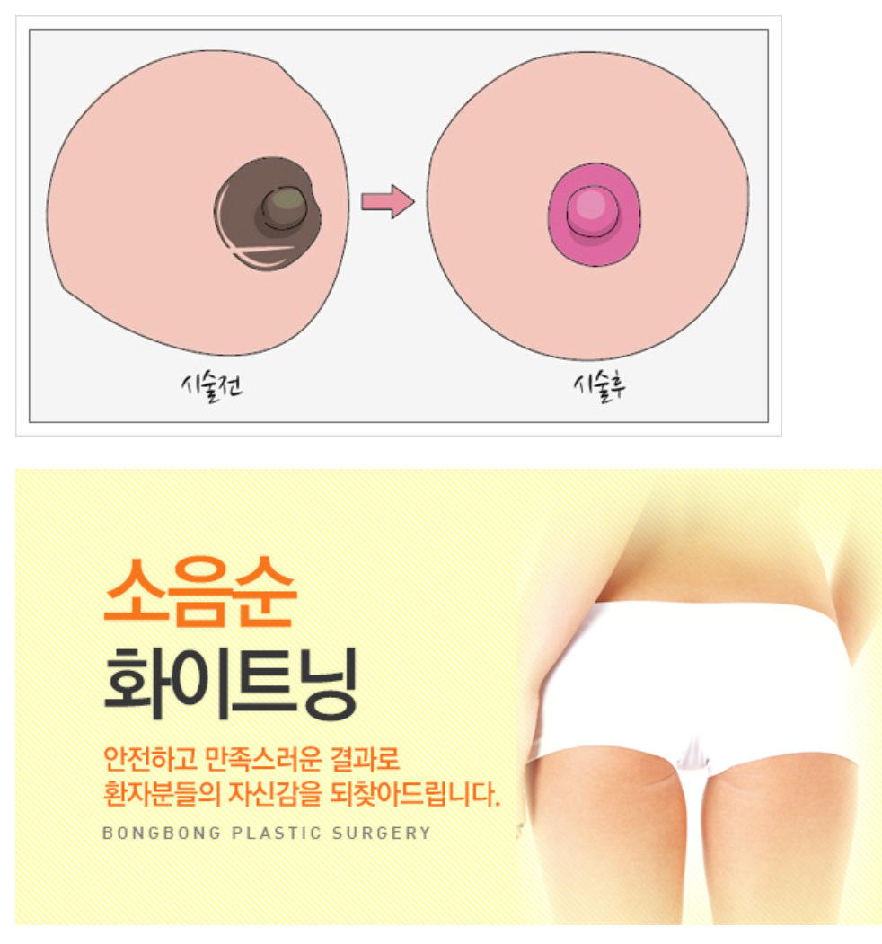 안되는게 없는 요즘 성형