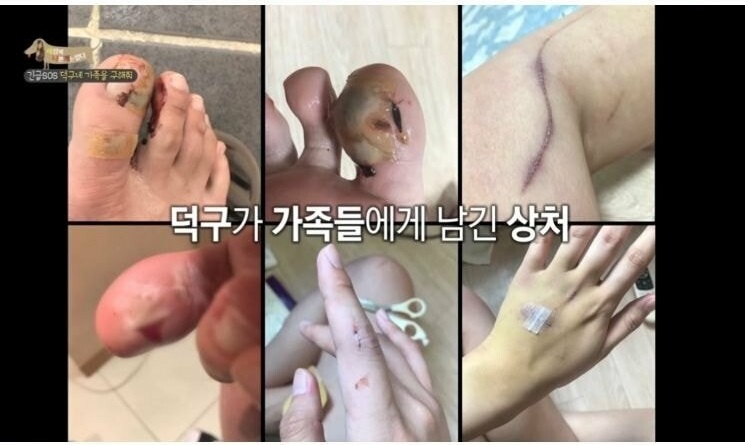 촬영 중 개한테 공격 받은 제작진