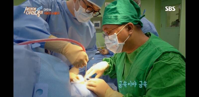 우산 촉이 머리 속에 들어간 사연