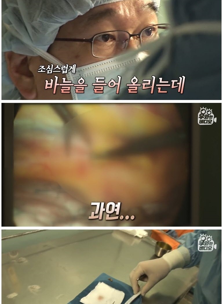 심장 1mm 앞에 꽂힌 바늘