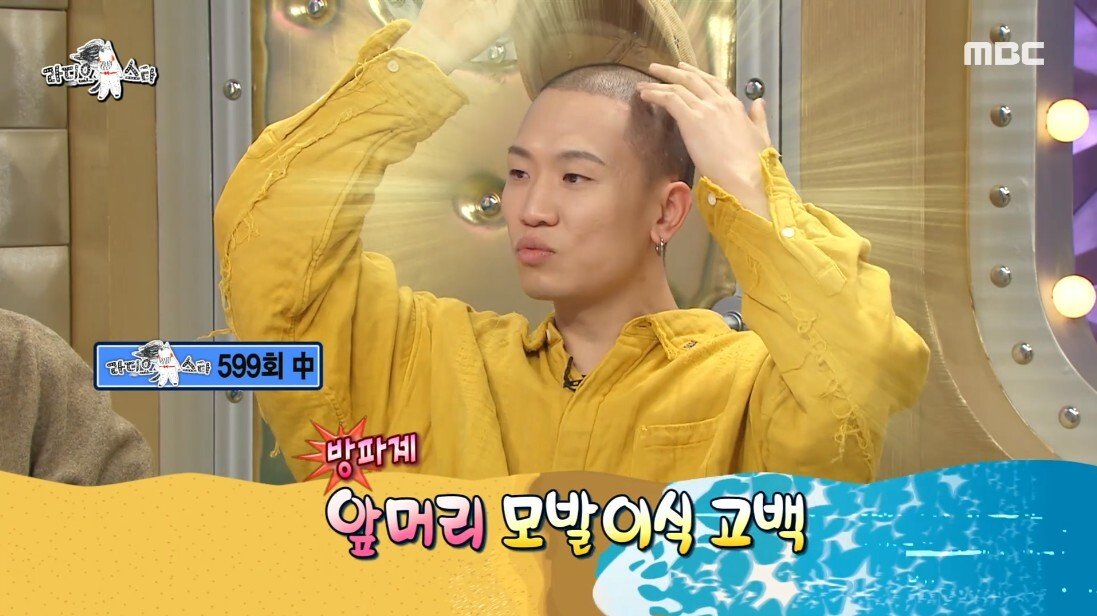 연예계 모발이식 브로커