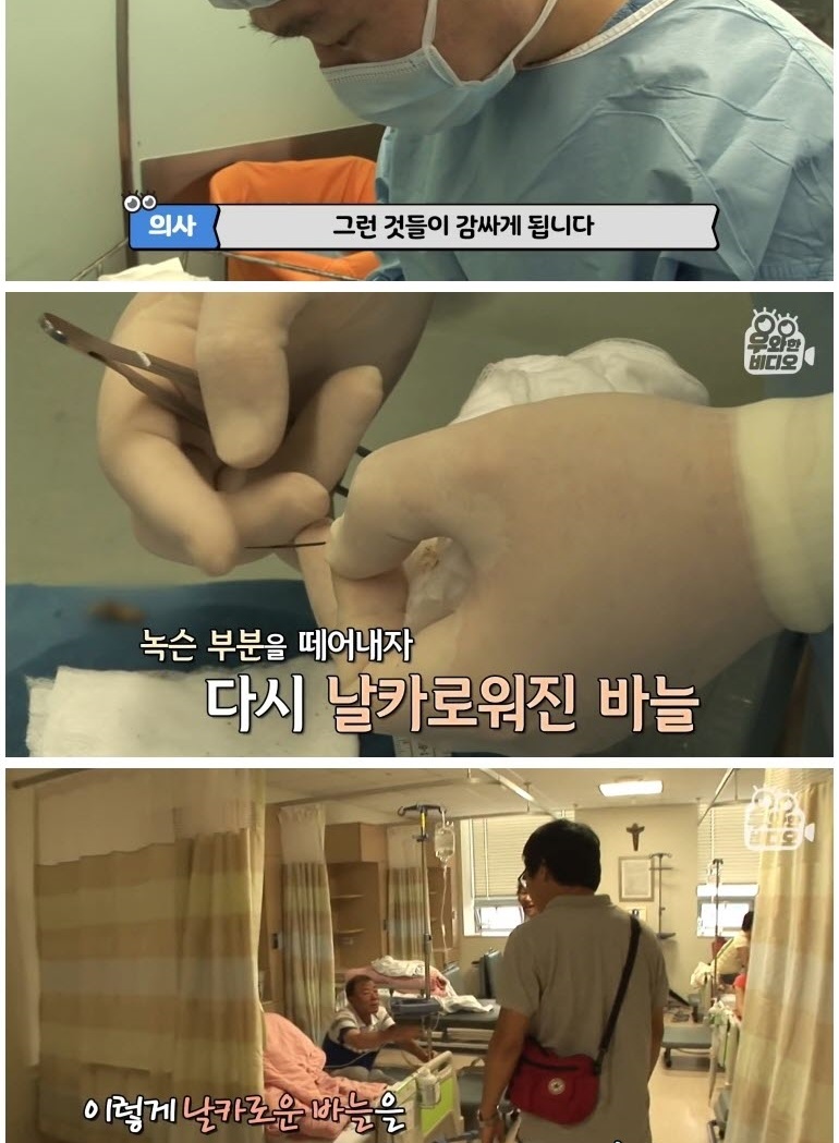심장 1mm 앞에 꽂힌 바늘
