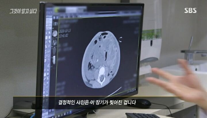 그것이 알고싶다 응급의학과 전문의 인터뷰