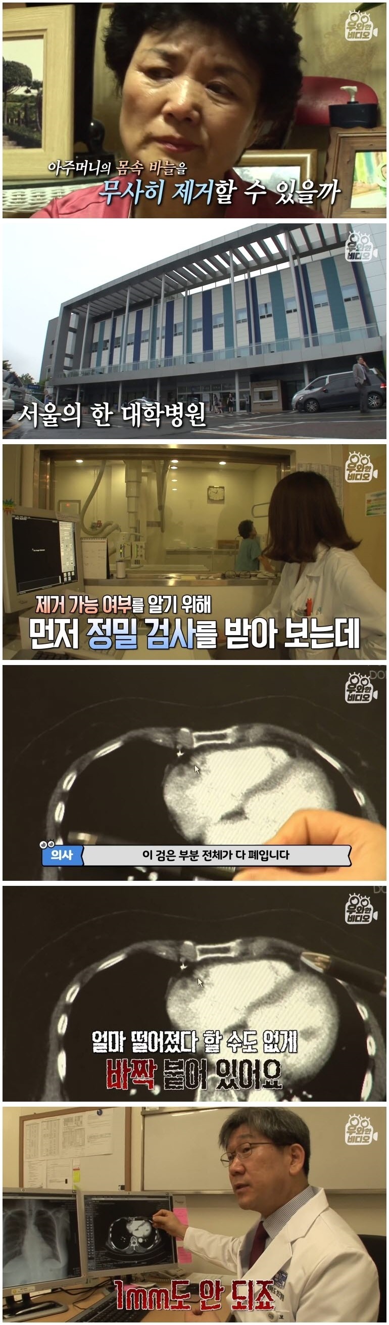 심장 1mm 앞에 꽂힌 바늘