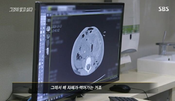 그것이 알고싶다 응급의학과 전문의 인터뷰