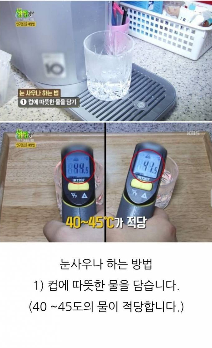 안구건조증에 좋은 눈 사우나