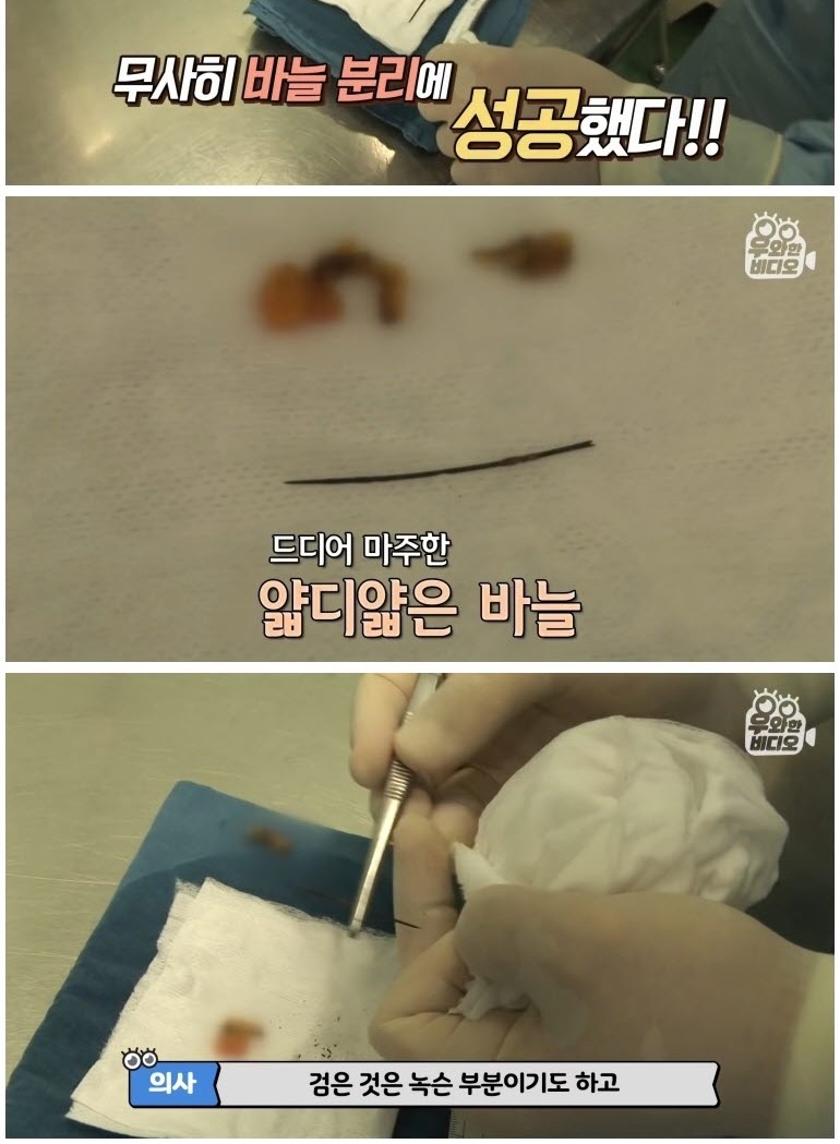 심장 1mm 앞에 꽂힌 바늘