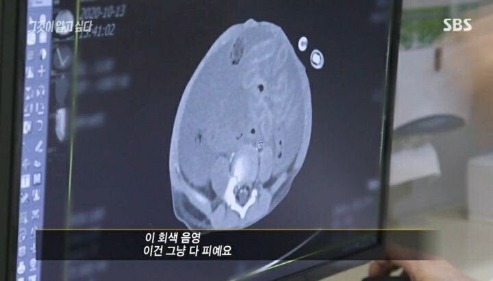 그것이 알고싶다 응급의학과 전문의 인터뷰