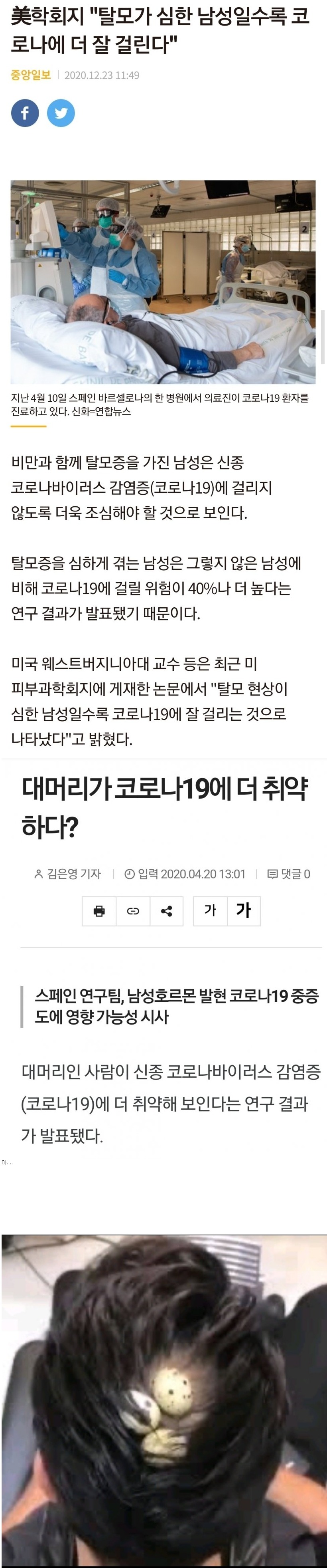 탈모인 것도 서러운데