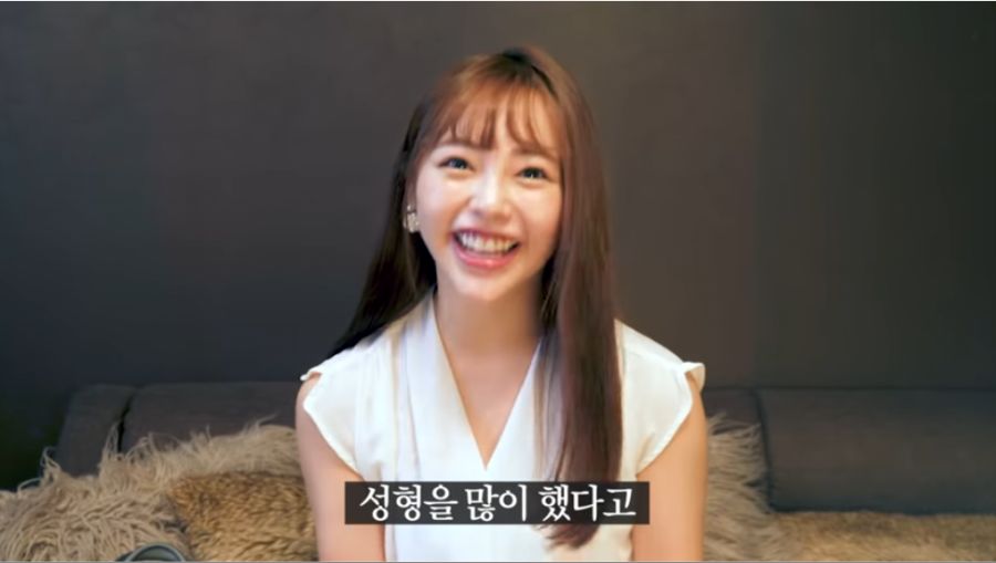 성형 논란 해명