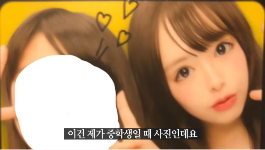 성형 논란 해명