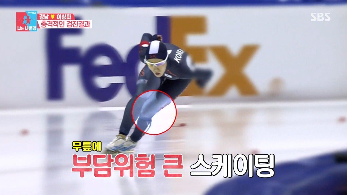 이상화의 현재 무릎 상태