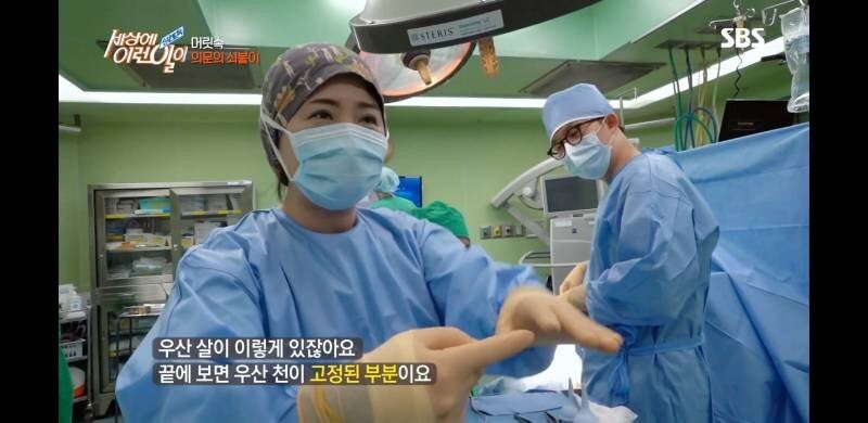 우산 촉이 머리 속에 들어간 사연
