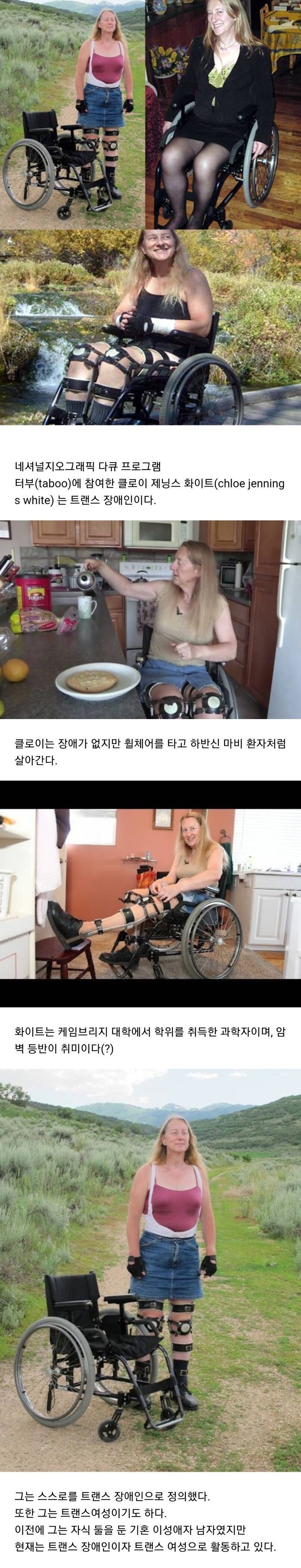 특이점이 온 장애인