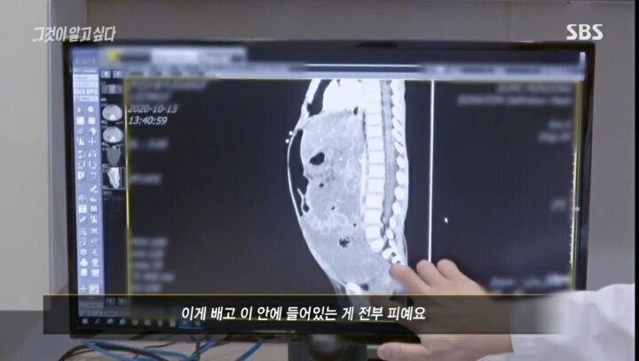 그것이 알고싶다 응급의학과 전문의 인터뷰