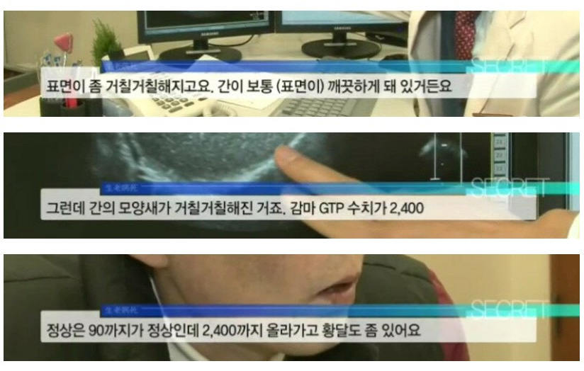 25년 동안 매일 소주 한 병