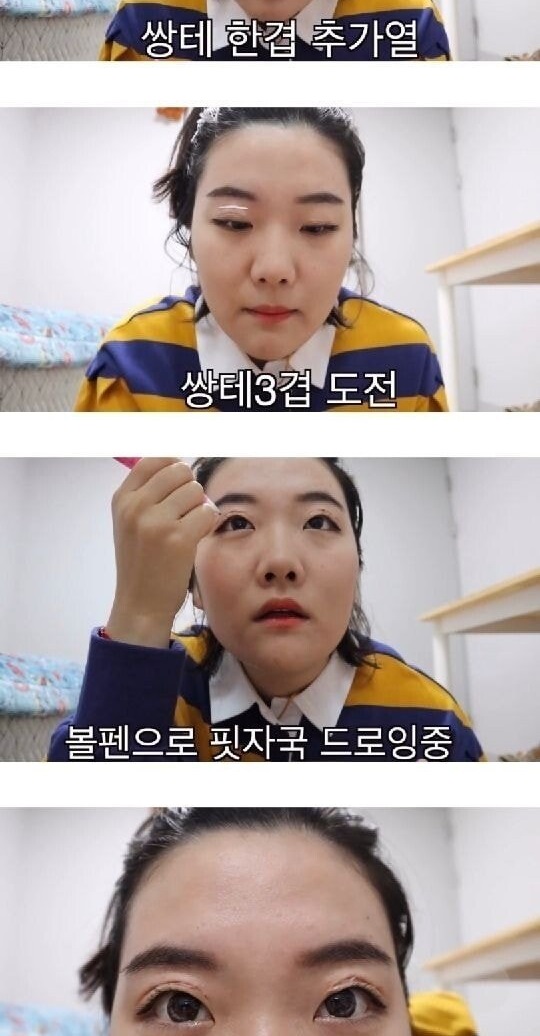 손녀가 몰래 쌍꺼풀 수술을 하면