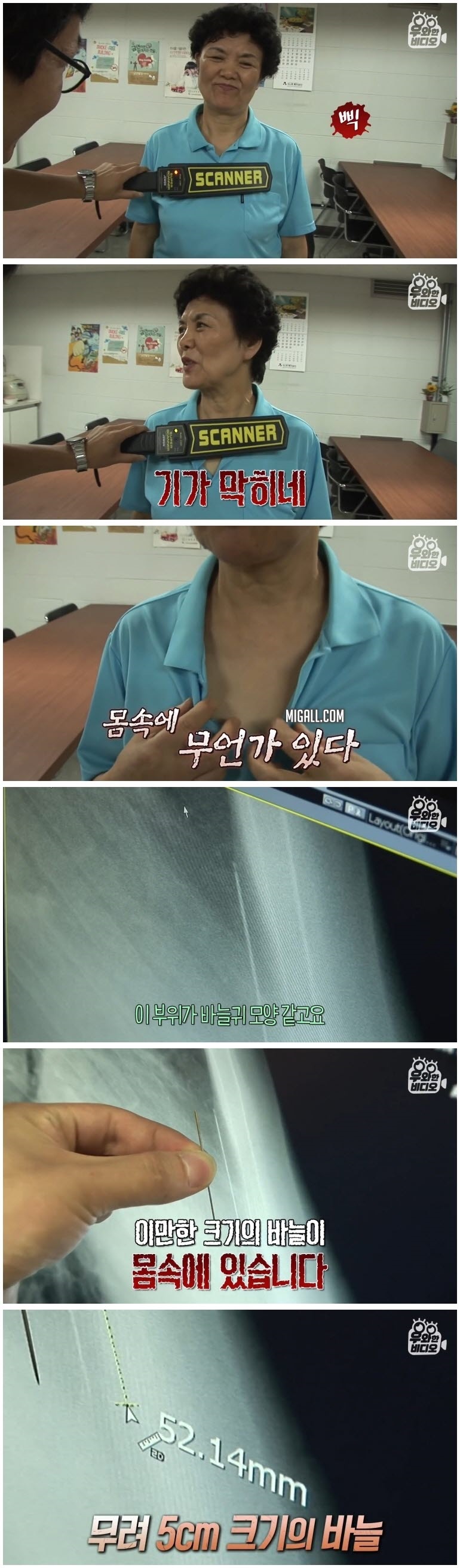 심장 1mm 앞에 꽂힌 바늘