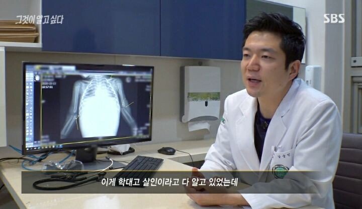 그것이 알고싶다 응급의학과 전문의 인터뷰