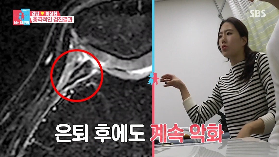 이상화의 현재 무릎 상태