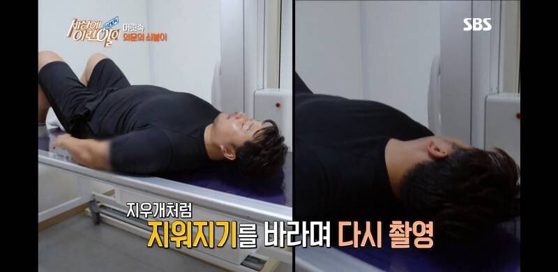 우산 촉이 머리 속에 들어간 사연