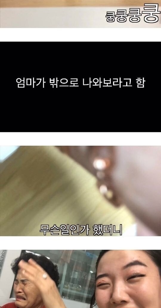 손녀가 몰래 쌍꺼풀 수술을 하면