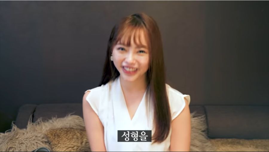 성형 논란 해명