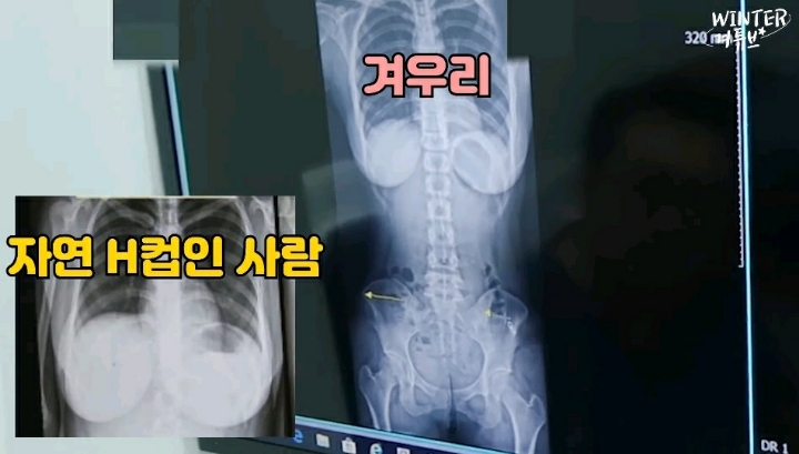 자연 H컵 인증한 비제이 겨울.gif