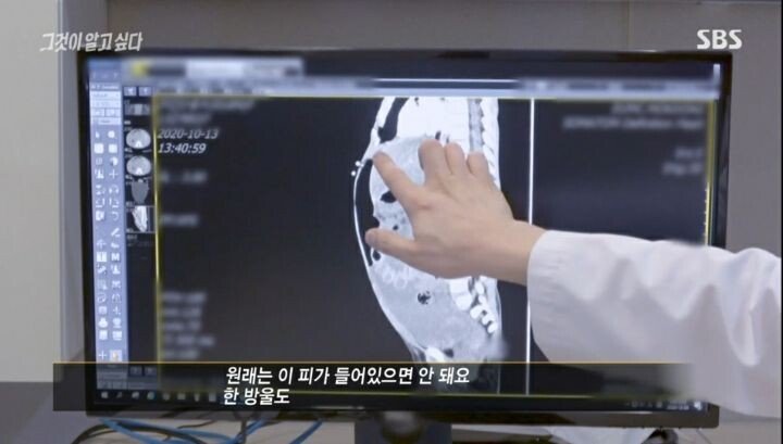 그것이 알고싶다 응급의학과 전문의 인터뷰