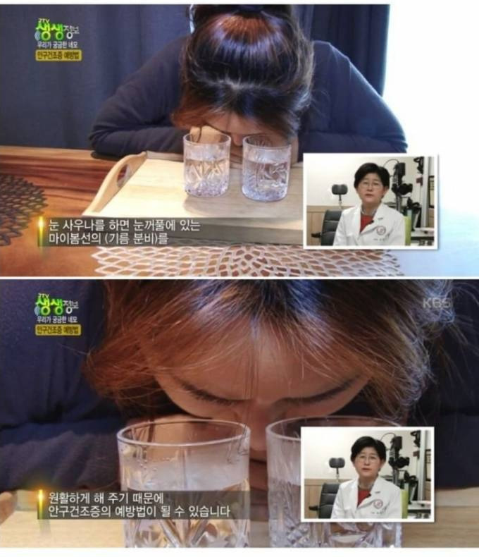 안구건조증에 좋은 눈 사우나