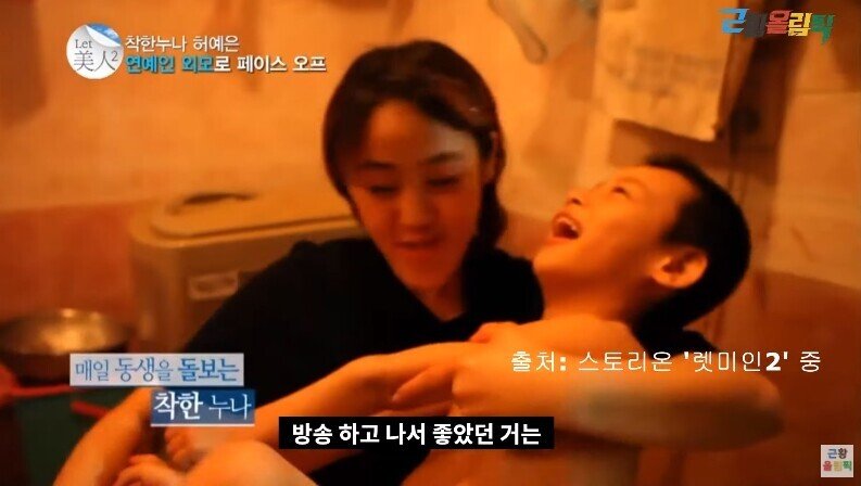 주걱턱녀의 성형 8년 후
