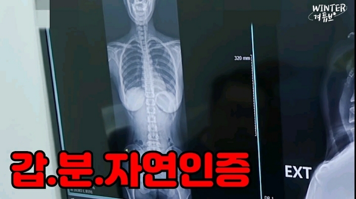 자연 H컵 인증한 비제이 겨울.gif