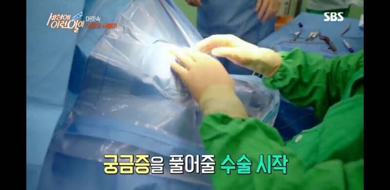 우산 촉이 머리 속에 들어간 사연