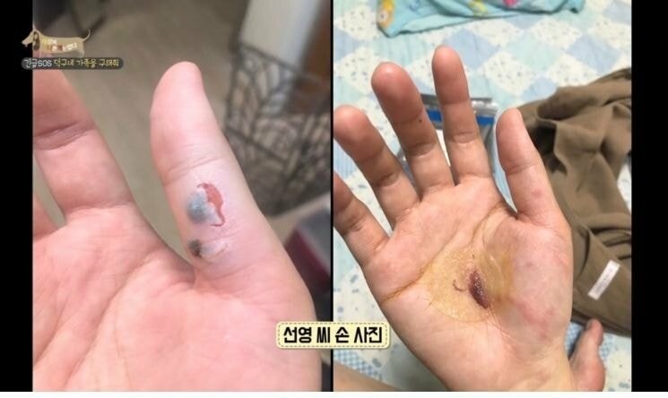 촬영 중 개한테 공격 받은 제작진