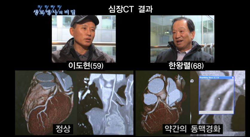 삼겹살 20년 동안 매일 먹은 사람의 몸 상태