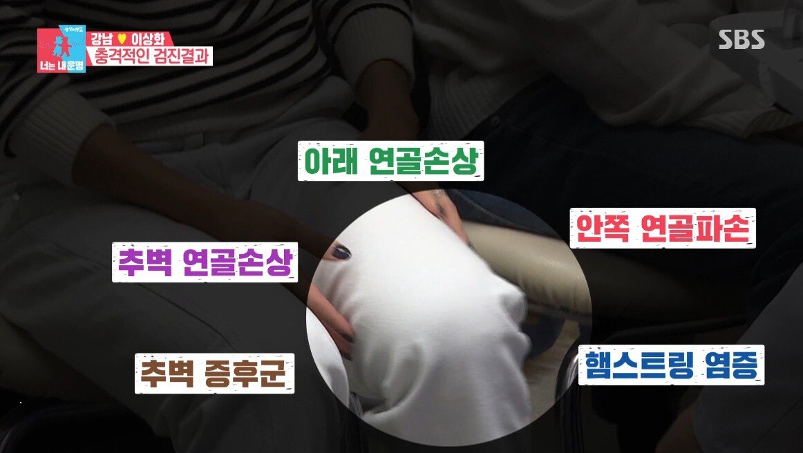 이상화의 현재 무릎 상태
