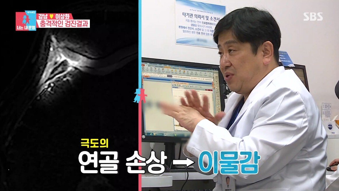 이상화의 현재 무릎 상태