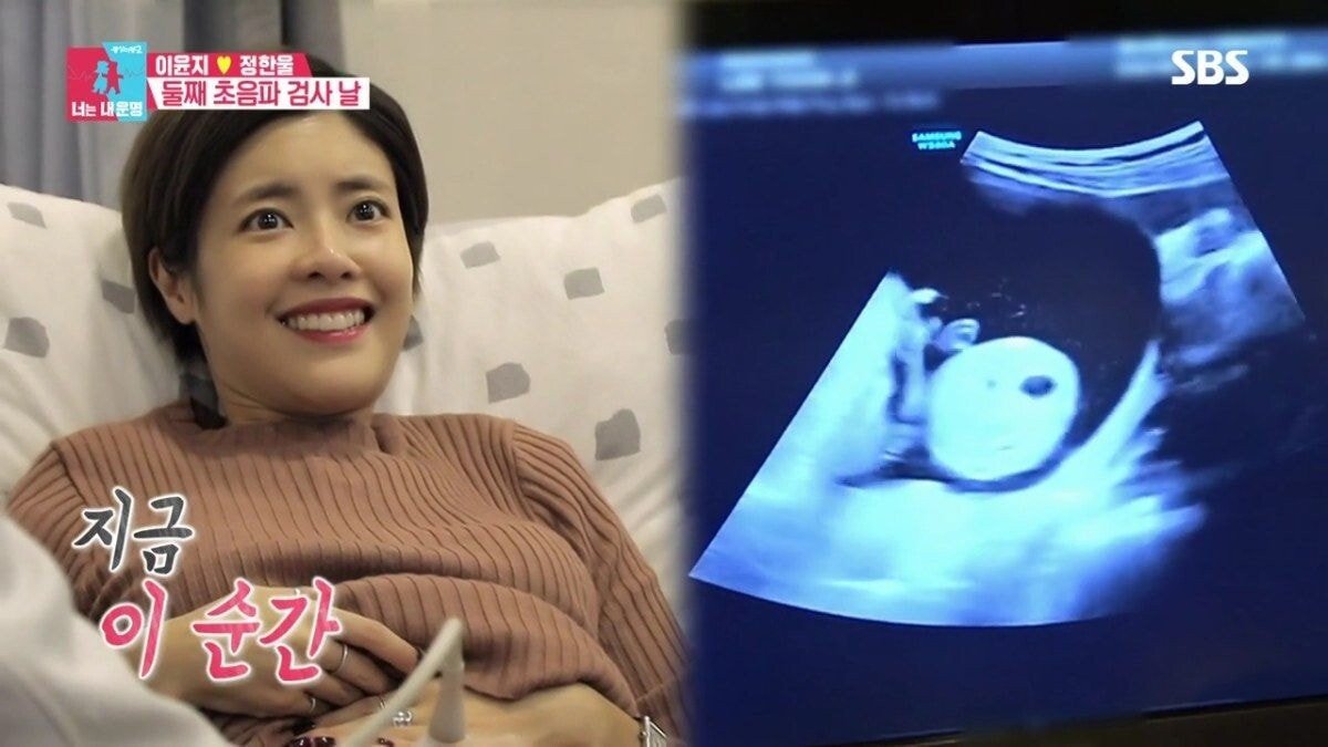 둘째를 임신한 이윤지가 말하는 유산 경험