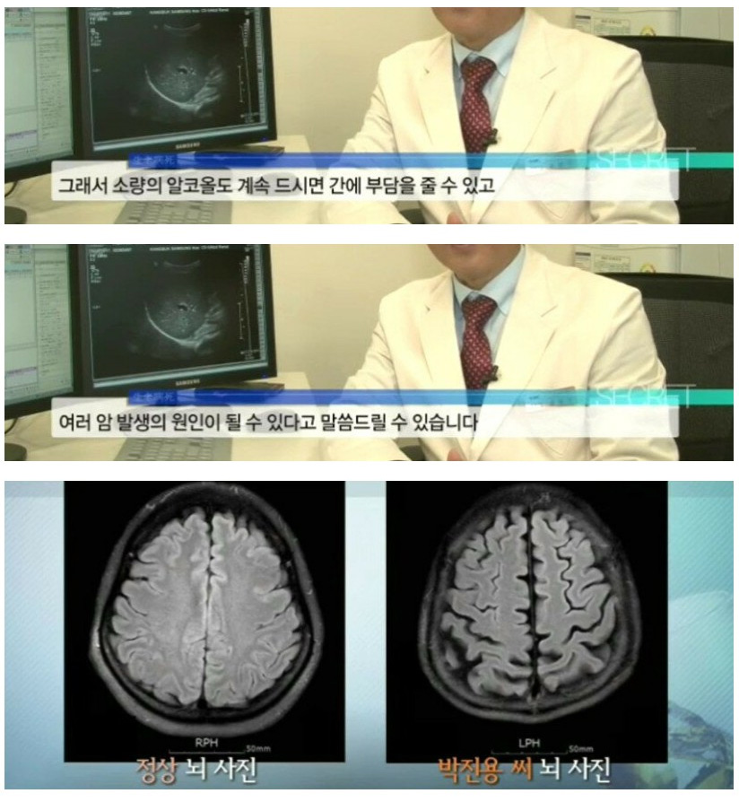25년 동안 매일 소주 한 병