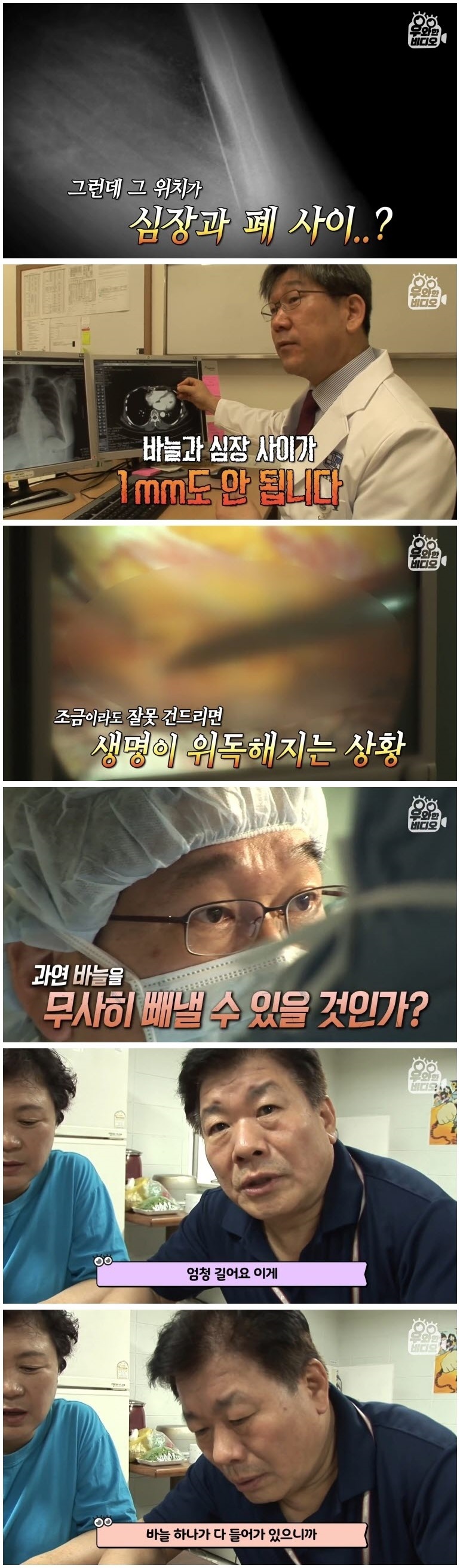 심장 1mm 앞에 꽂힌 바늘