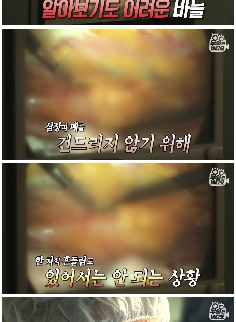 심장 1mm 앞에 꽂힌 바늘