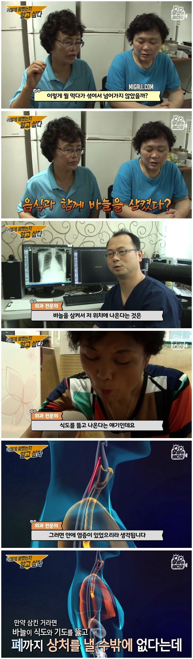 심장 1mm 앞에 꽂힌 바늘