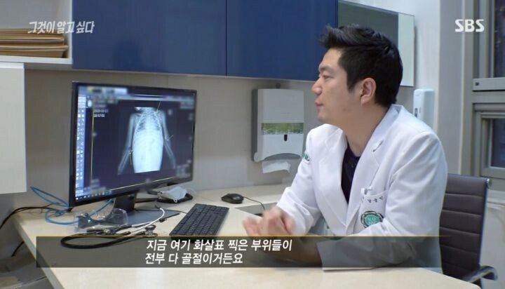 그것이 알고싶다 응급의학과 전문의 인터뷰