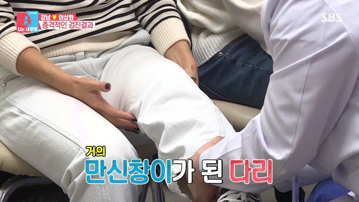 이상화의 현재 무릎 상태