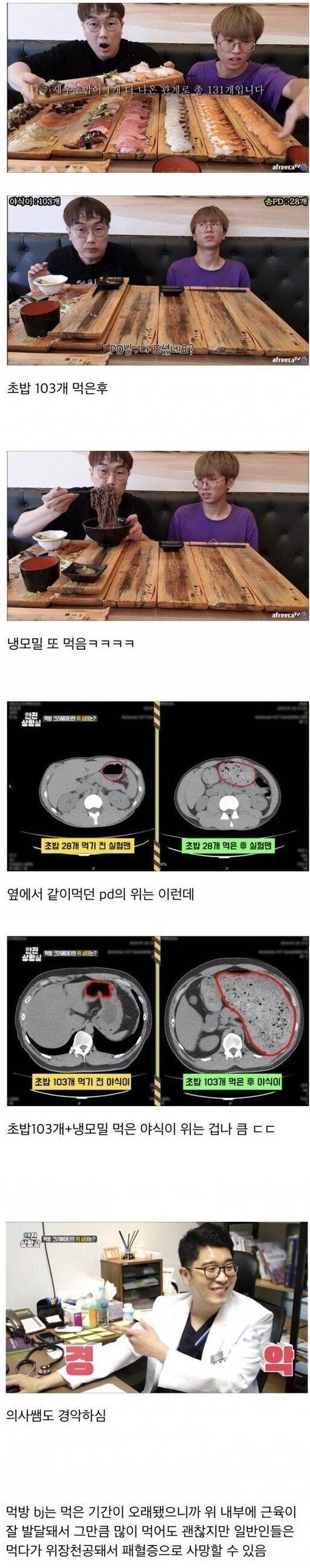 초밥 103개와 냉모밀 먹은 먹방BJ 위 상태