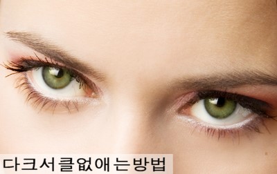 다크서클없애는방법 - 다크서클수술 눈밑지방이식