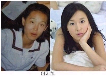 과연성형인가..