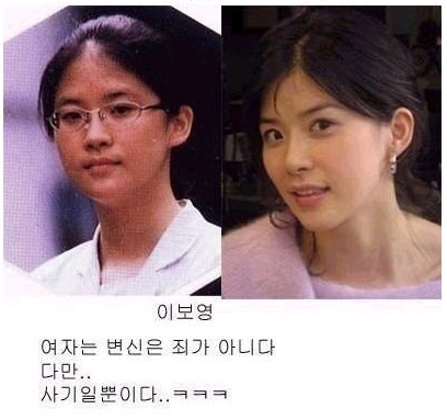과연성형인가..