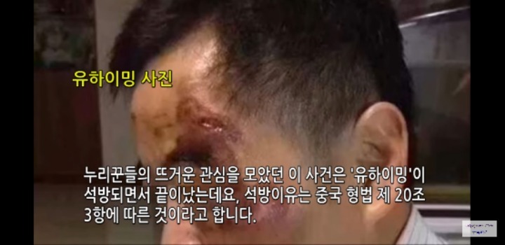 칼 들고 덤벼든 조폭 살해한 시민