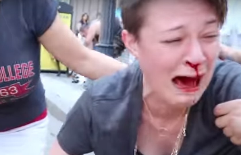 산책 중 핏불에게 공격당한 비글